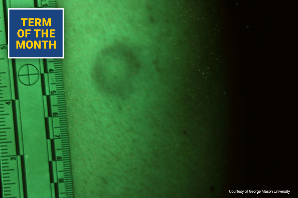 Alternate Light Source